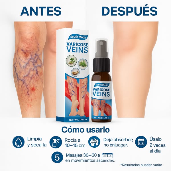 🌿Varicose Veins ✨¡Clínicamente probado para eliminar las venas varicosas✅